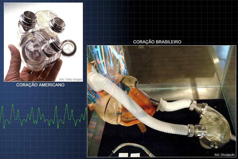 Coração artificial brasileiro